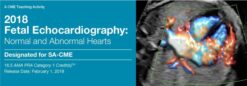 2018 Fetal Echocardiography: Normal and Abnormal Hearts (Videos)