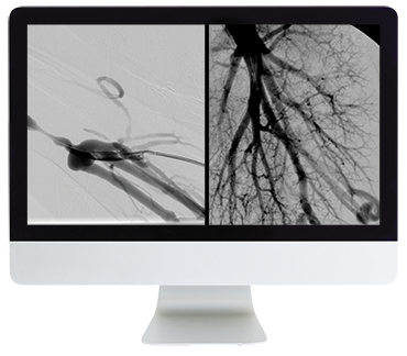 ARRS Case Review of Vascular and Interventional Radiology 2023