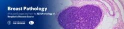 MSKCC Breast Pathology – The Pathology of Neoplastic Diseases 2025 (Videos with subtitles + Slides)