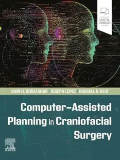 Computer-Assisted Planning In Craniofacial Surgery (EPub + Converted PDF + Videos)