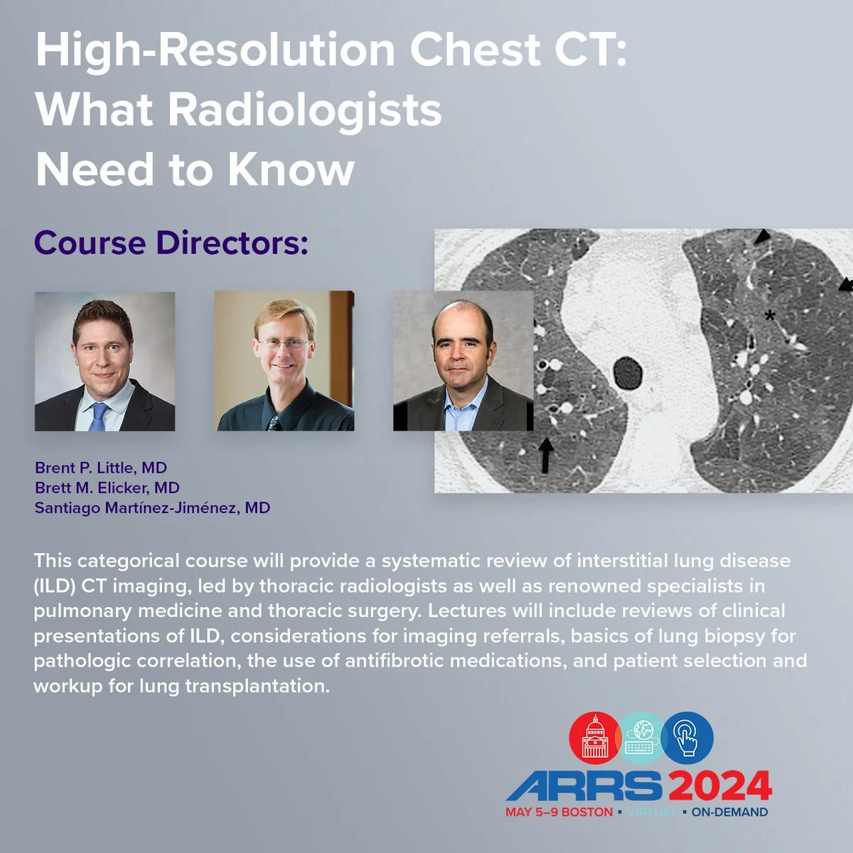 ARRS High-Resolution Chest CT: What Radiologists Need To Know 2024