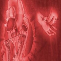 Mayo Clinic Interventional Cardiology Board Review 2019