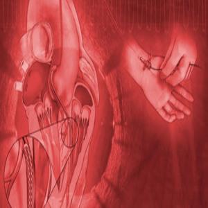 Mayo Clinic Interventional Cardiology Board Review 2019