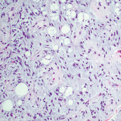 Cleveland Clinic Comprehensive and Immersive Soft Tissue Pathology 2025