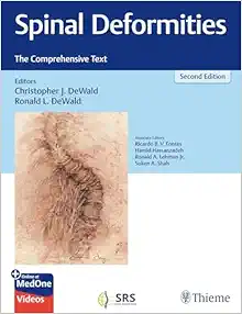 Spinal Deformities: The Comprehensive Text, 2nd edition (Original PDF from Publisher + Videos)