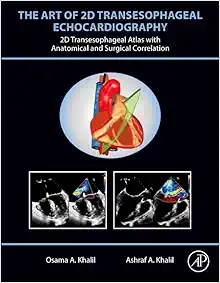 The Art Of 2D Transesophageal Echocardiography (PDF Book + Videos )