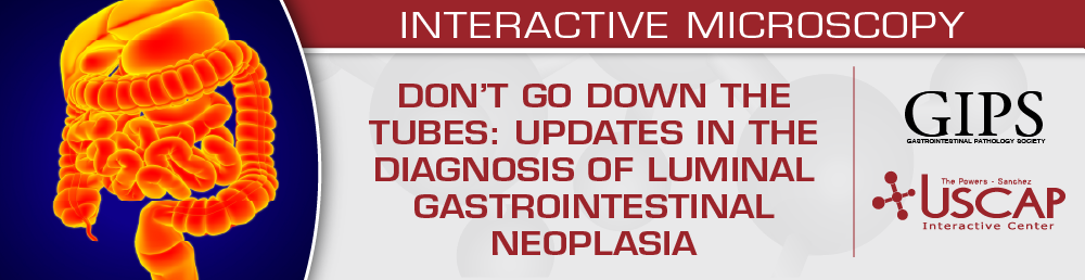 USCAP Don’t Go Down the Tubes Updates in the Diagnosis of Luminal Gastrointestinal Neoplasia 2025